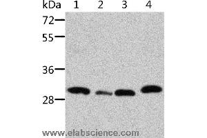 Western blot analysis of Mouse pancreas and spleen tissue, mouse heart tissue and 293T cell, using STRADB Polyclonal Antibody at dilution of 1:500 (STRADB Antikörper)