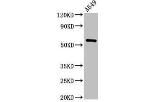 Western Blot Positive WB detected in: A549 whole cell lysate All lanes: TRIM21 antibody at 2 μg/mL Secondary Goat polyclonal to rabbit IgG at 1/50000 dilution Predicted band size: 55, 46 kDa Observed band size: 55 kDa (TRIM21 Antikörper  (AA 1-475))