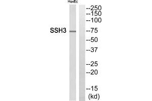 Western blot analysis of extracts from HuvEc cells, using SSH3 antibody. (SSH3 Antikörper  (Internal Region))