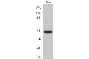 Western Blotting (WB) image for anti-Caspase 9, Apoptosis-Related Cysteine Peptidase (CASP9) (pThr125) antibody (ABIN3182484) (Caspase 9 Antikörper  (pThr125))