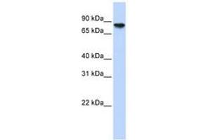 Image no. 1 for anti-Glycogen Synthase 2, Liver (GYS2) (AA 612-661) antibody (ABIN6740933) (Glycogen Synthase 2 Antikörper  (AA 612-661))