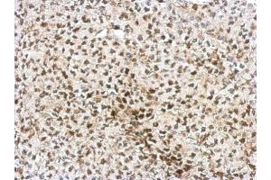 IHC-P Image Immunohistochemical analysis of paraffin-embedded D54 xenograft, using AF9, antibody at 1:750 dilution.