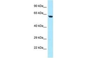 Image no. 1 for anti-Transforming Growth Factor beta Regulator 4 (TBRG4) (AA 43-92) antibody (ABIN6747962)