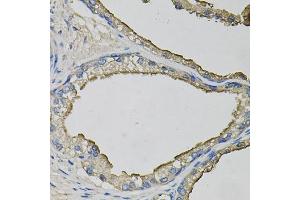 Immunohistochemistry of paraffin-embedded human prostate using LCN1 antibody. (Lipocalin 1 Antikörper)