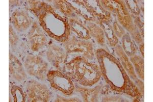 Immunohistochemistry (IHC) image for anti-TNF Receptor-Associated Factor 2 (TRAF2) antibody (ABIN7127853)