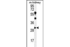CCNG1 Antibody (C-term) (ABIN655159 and ABIN2844777) western blot analysis in mouse kidney tissue lysates (35 μg/lane). (Cyclin G1 Antikörper  (C-Term))