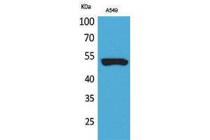 Western Blotting (WB) image for anti-Keratin 8 (KRT8) (Ser726), (Ser731) antibody (ABIN3178358) (KRT8 Antikörper  (Ser726, Ser731))