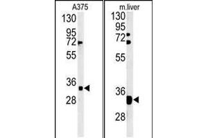 (LEFT)Western blot analysis of FYTD1 Antibody (N-term) (ABIN651416 and ABIN2840226) in  cell line lysates (35 μg/lane). (FYTTD1 Antikörper  (N-Term))