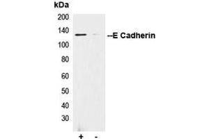 Immunoprecipitation (IP) image for anti-Cadherin 1, Type 1, E-Cadherin (Epithelial) (CDH1) (C-Term) antibody (ABIN7295214)