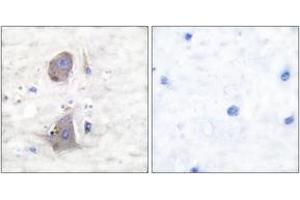 Immunohistochemistry analysis of paraffin-embedded human brain tissue, using GLUT1 Antibody.