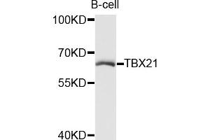 Western blot analysis of extracts of B-cell cells, using TBX21 antibody (ABIN5972689) at 1/1000 dilution. (T-Bet Antikörper)
