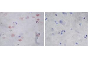 Immunohistochemistry analysis of human brain tissue slide (Paraffin embedded) using Rabbit Anti-Parkin Polyclonal Antibody (left, ABIN398785) and Purified Rabbit IgG (whole molecule) Control (right, ABIN398653) (Parkin Antikörper  (AA 300-350))