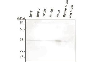 Western blot analysis. (HTRA2 Antikörper  (AA 134-458))