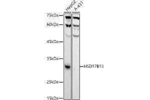 Western blot analysis of extracts of various cell lines, using HSD17B13 antibody (ABIN7267809) at 1:1000 dilution. (HSD17B13 Antikörper)