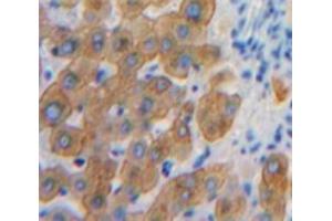 Used in DAB staining on fromalin fixed paraffin-embedded Liver tissue (SHB Antikörper  (AA 248-484))
