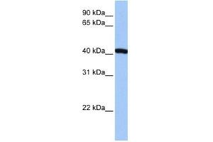 FTSJ1 antibody used at 1 ug/ml to detect target protein.