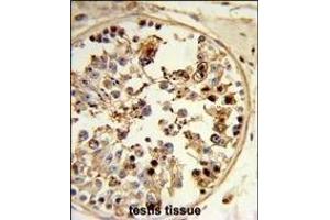 Immunohistochemistry (Paraffin-embedded Sections) (IHC (p)) image for anti-Alveolar Soft Part Sarcoma Chromosome Region, Candidate 1 (ASPSCR1) (AA 392-418), (C-Term) antibody (ABIN652768)