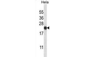 Western Blotting (WB) image for anti-Proteasome (Prosome, Macropain) Subunit, beta Type, 5 (PSMB5) antibody (ABIN2998050) (PSMB5 Antikörper)