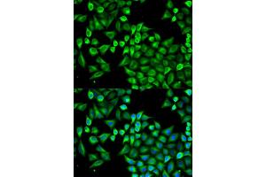 Immunofluorescence analysis of A549 cells using ABAT antibody. (ABAT Antikörper)