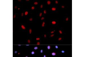 Immunofluorescence analysis of U2OS cells using Phospho-MAP2K6(S207)/MAP2K3(S189) Polyclonal Antibody (MAP2K6 Antikörper  (pSer189, pSer207))