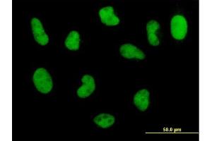 Immunofluorescence of monoclonal antibody to POLD3 on HeLa cell. (POLD3 Antikörper  (AA 357-466))