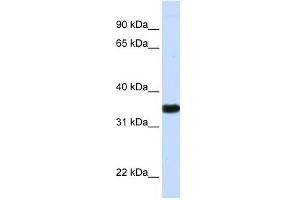 GAPDH antibody used at 1 ug/ml to detect target protein. (GAPDH Antikörper  (N-Term))
