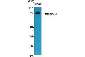 Western Blot (WB) analysis of specific cells using Catenin-beta1 Polyclonal Antibody.