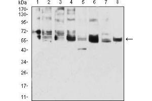Western blot analysis using CK5 mouse mAb against A431 (1), 3T3-L1 (2), COS7 (3), MCF-7 (4), SK-Br-3 (5), Hela (6), Lncap (7), and HepG2 (8) cell lysate. (Cytokeratin 5 Antikörper  (AA 258-357))