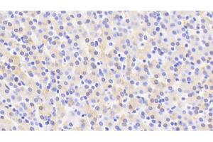 Detection of CYP2D6 in Human Liver Tissue using Polyclonal Antibody to Cytochrome P450 2D6 (CYP2D6) (CYP2D6 Antikörper  (AA 236-472))
