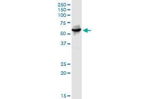 Western Blotting (WB) image for anti-Tryptophanyl-tRNA Synthetase (WARS) (AA 1-471) antibody (ABIN950051)