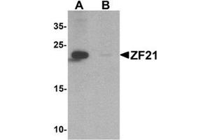 Western blot analysis of ZF21 in 3T3 cell tissue lysate with ZF21 Antibody  at 1 µg/ml in (A) the absence and (B) the presence of blocking peptide. (ZFYVE21 Antikörper  (N-Term))