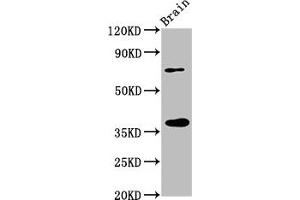 Western Blot Positive WB detected in: Rat brain tissue All lanes: EIF3I antibody at 3.