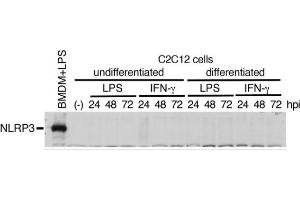 Mouse C2C12 myoblasts or the differentiated myocytes using horse serum were treated with LPS (1 μg/mL) or IFN-γ (100 ng/mL) for 24 to 72 h.