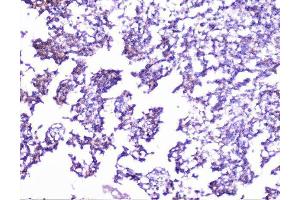 IHC analysis of cortactin using anti-cortactin antibody (ABIN6719306).