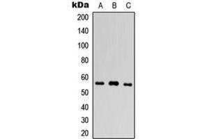 Western blot analysis of PLXDC1 expression in HEK293T (A), Raw264. (PLXDC1 Antikörper  (Center))