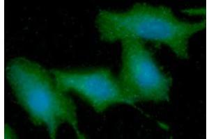 ICC/IF analysis of KRT5 in A549 cells line, stained with DAPI (Blue) for nucleus staining and monoclonal anti-human KRT5 antibody (1:100) with goat anti-mouse IgG-Alexa fluor 488 conjugate (Green).