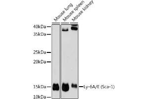 Western blot analysis of extracts of various cell lines, using Ly-6A/E (Sca-1) antibody (ABIN7268313) at 1:1000 dilution. (Sca-1/Ly-6A/E Antikörper)