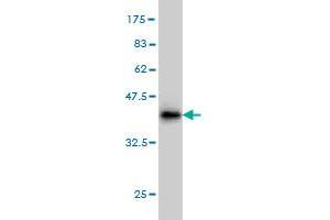 Western Blot detection against Immunogen (36. (DAZ1 Antikörper  (AA 21-120))