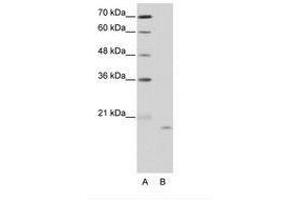 Image no. 1 for anti-Nucleolar Protein 6 (NOL6) (C-Term) antibody (ABIN203026) (Nucleolar Protein 6 Antikörper  (C-Term))