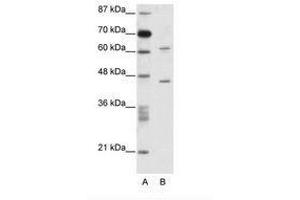 Image no. 1 for anti-TRM1 tRNA Methyltransferase 1-Like (TRMT1L) (AA 61-110) antibody (ABIN6736084) (TRMT1L Antikörper  (AA 61-110))