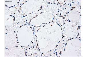 Immunohistochemical staining of paraffin-embedded lung tissue using anti-MAP2K4mouse monoclonal antibody. (MAP2K4 Antikörper)