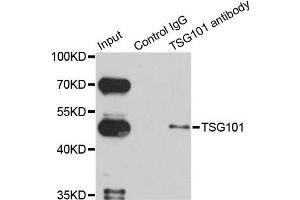 Immunoprecipitation analysis of 150ug extracts of HeLa cells using 3ug TSG101 antibody. (TSG101 Antikörper)