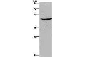 Western blot analysis of K562 cell, using ACP6 Polyclonal Antibody at dilution of 1:200 (ACP6 Antikörper)