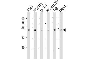All lanes : Anti-TPD52 Antibody (C-Term) at 1:2000 dilution Lane 1: A549 whole cell lysate Lane 2: HC whole cell lysate Lane 3: MCF-7 whole cell lysate Lane 4: NCI- whole cell lysate Lane 5: Raji whole cell lysate Lane 6: THP-1 whole cell lysate Lysates/proteins at 20 μg per lane. (TPD52 Antikörper  (AA 193-223))