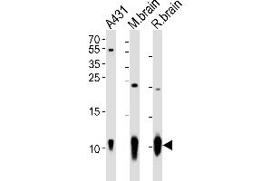 Western blot analysis of lysates from A431 cell line, mouse brain, rat brain tissue (from left to right), using S100B Antibody (ABIN651265 and ABIN2840160).