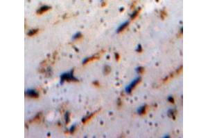 Used in DAB staining on fromalin fixed paraffin-embedded Brain tissue