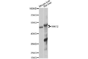 Western blot analysis of extracts of various cell lines, using WNT2 Antibody (ABIN6292350) at 1:1000 dilution. (WNT2 Antikörper)