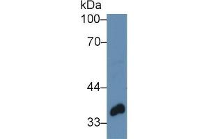 Western blot analysis of Pig Mammary gland lysate, using Human TWF1 Antibody (3 µg/ml) and HRP-conjugated Goat Anti-Rabbit antibody ( (TWF1 Antikörper  (AA 1-252))