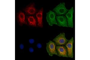 ABIN6257664 and ABIN6273422 staining Hela cells by IF/ICC.