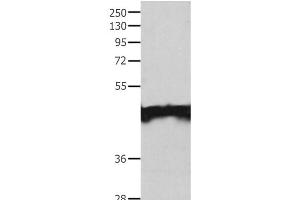 Western Blot analysis of Jurkat cell using MAT1A Polyclonal Antibody at dilution of 1:200 (MAT1A Antikörper)